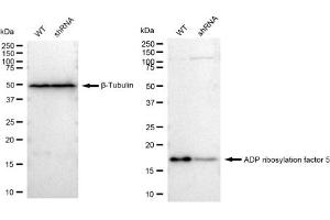 Western blotting analysis using ADP ribosylation factor 5 antibody (ABIN7797531).