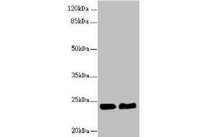 Western blot All lanes: RAB5B antibody at 5. (RAB5B 抗体  (AA 1-215))
