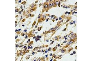 Immunohistochemical analysis of EIF3A staining in human stomach formalin fixed paraffin embedded tissue section. (EIF3A 抗体)