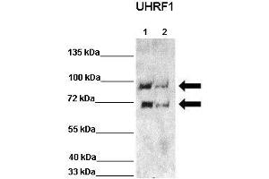 WB Suggested Anti-UHRF1 Antibody  Positive Control: Lane 1: 60ug HCT116 lysate Lane 2: 60ug HCT116 lysate + siRNA  Primary Antibody Dilution :  1:1000 Secondary Antibody : Anti rabbit-HRP  Secondry Antibody Dilution :  1:5,000 Submitted by: Chinweike Ukomadu, Brigham and Women's Hospital, Boston (UHRF1 抗体  (N-Term))
