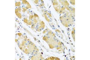 Immunohistochemistry of paraffin-embedded human stomach using C4BPB antibody (ABIN5973770) at dilution of 1/100 (40x lens). (C4BPB 抗体)
