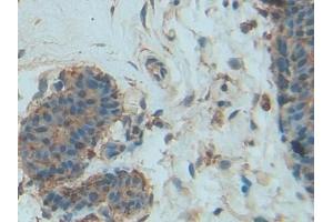 DAB staining on IHC-P; Samples: Human Mammary gland Tissue (PDGF-BB Homodimer (AA 82-190) 抗体)