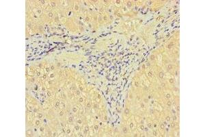 Immunohistochemistry of paraffin-embedded human liver tissue using ABIN7170681 at dilution of 1:100 (SRPK3 抗体  (AA 1-300))