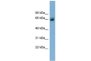 WB Suggested Anti-SLFN12 Antibody Titration: 0. (SLFN12 抗体  (N-Term))