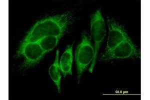 Immunofluorescence of purified MaxPab antibody to HK1 on HeLa cell. (Hexokinase 1 抗体  (AA 1-916))