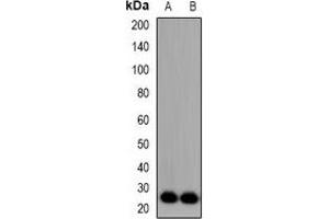 Western blot analysis of FGF11 expression in Hela (A), NIH3T3 (B) whole cell lysates. (FGF11 抗体)