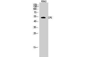 Western Blotting (WB) image for anti-Carboxypeptidase E (CPE) (Internal Region) antibody (ABIN3184066)