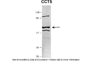 Sample Type: HEK 293 (10ug)Primary Dilution: 1:1000Secondary Antibody: conjugated goat anti-rabbitSecondary Dilution: 1:10,000Image Submitted By: Amy GrayBrigham Young University (CCT5 抗体  (N-Term))