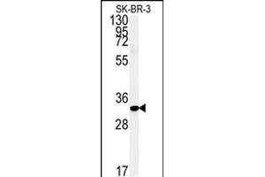 Western blot analysis of FA1 Antibody (Center) (ABIN651364 and ABIN2840202) in SK-BR-3 cell line lysates (35 μg/lane). (FAM92A1 抗体  (AA 113-141))