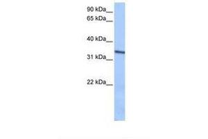 Image no. 1 for anti-Septin 9 (SEPT9) (C-Term) antibody (ABIN6749752) (Septin 9 抗体  (C-Term))