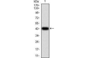 Western blot analysis using IL1RAPL1 mAb against human IL1RAPL1 (AA: 541-694) recombinant protein. (IL1RAPL1 抗体  (AA 541-694))