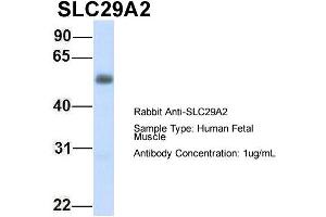 Western Blotting (WB) image for anti-Solute Carrier Family 29 (Nucleoside Transporters), Member 2 (SLC29A2) (C-Term) antibody (ABIN2781572)