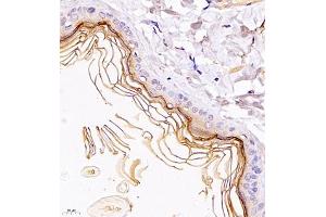 Immunohistochemistry of paraffin embedded rat skin using TR2IT1 (ABIN7075887) at dilution of 1:1500 (400x lens) (TXNRD3NB 抗体)