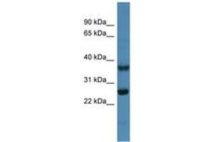 Image no. 1 for anti-ATP Synthase, H+ Transporting, Mitochondrial Fo Complex, Subunit B1 (ATP5F1) (AA 45-94) antibody (ABIN6746288)