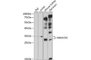 Western blot analysis of extracts of various cell lines, using MMACHC antibody  at 1:1000 dilution. (MMACHC 抗体  (AA 63-282))