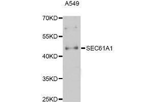 Western blot analysis of extracts of A-549 cells, using SEC61A1 Antibody (ABIN5998768) at 1:3000 dilution. (SEC61A1 抗体)