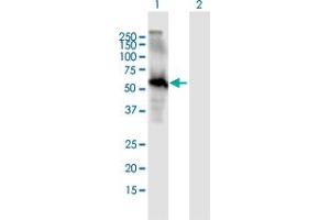 Western Blot analysis of EGFL6 expression in transfected 293T cell line by EGFL6 MaxPab polyclonal antibody. (EGFL6 抗体  (AA 1-553))