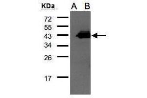 WB Image Western Blot analysis of CCNDBP1 expression in transfected 293T cell line by CCNDBP1 polyclonal antibody. (CCNDBP1 抗体  (C-Term))
