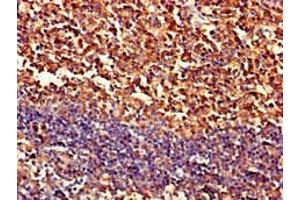 Immunohistochemistry of paraffin-embedded human tonsil tissue using ABIN7162982 at dilution of 1:100 (PIPOX 抗体  (AA 259-337))