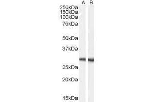 Western Blotting (WB) image for Doublecortin Domain Containing 2 (DCDC2) peptide (ABIN369575) (Doublecortin Domain Containing 2 (DCDC2) Peptide)