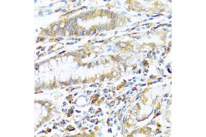 Immunohistochemistry of paraffin-embedded human stomach using HLA-DPB1 antibody at dilution of 1:100 (40x lens). (HLA-DPB1 抗体)