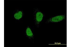 Immunofluorescence of monoclonal antibody to RNF220 on HeLa cell. (RNF220 抗体  (AA 468-566))