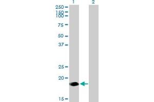 Western Blot analysis of NINJ2 expression in transfected 293T cell line by NINJ2 MaxPab polyclonal antibody. (NINJ2 抗体  (AA 1-188))
