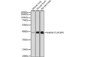 Western blot analysis of extracts of various cell lines, using hnRNP E1/hnRNP E1/PCBP1 antibody (ABIN7269448) at 1:1000 dilution. (PCBP1 抗体)