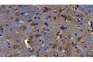 Immunohistochemistry (IHC) image for anti-Toll-Like Receptor Adaptor Molecule 1 (TICAM1) (AA 443-685) antibody (ABIN7441424)