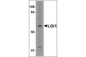 Western blot analysis of LGI1 in HeLa cell lysate with this product at 2 μg/ml. (LGI1 抗体  (Center))