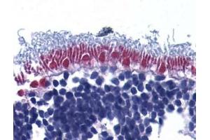 Immunohistochemistry of AIF in human retina with AIF (IN) antibody at 10μg/ml. (AIF 抗体)