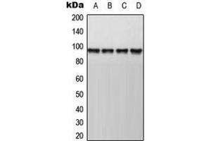 Western blot analysis of AKAP8 expression in HepG2 (A), Jurkat (B), mouse kidney (C), rat kidney (D) whole cell lysates.