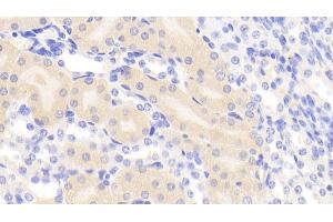Detection of EIF2aK3 in Mouse Kidney Tissue using Polyclonal Antibody to Eukaryotic Translation Initiation Factor 2 Alpha Kinase 3 (EIF2aK3)