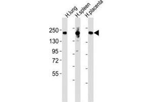 Western Blotting (WB) image for anti-Mannose Receptor, C Type 1 (MRC1) (AA 359-388) antibody (ABIN3028820)