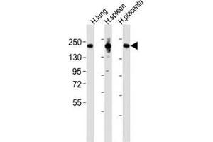 Western blot testing of MRC1L1 antibody at 1:2000 dilution and human samples: Lane 1: lung lysate; 2: spleen lysate; 3: placenta lysate; Predicted band size : 166 kDa.