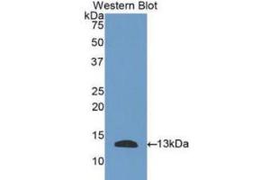 Western blot analysis of the recombinant protein. (PLAUR 抗体  (AA 123-216))