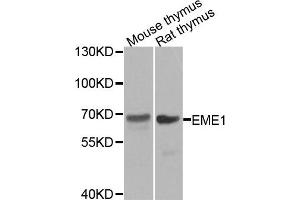 Western blot analysis of extracts of mouse thymus and rat thymus tissues, using EME1 antibody. (Crossover junction endonuclease EME1 (EME1) 抗体)