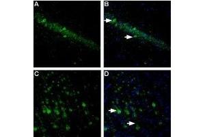 Expression of NLGN1 in rat hippocampus and cortexImmunohistochemical staining of free floating frozen section of rat hippocampal CA1 region (A, B) and rat parietal cortex (C, D) using Anti-Neuroligin 1 (extracellular) Antibody (ABIN7043361, ABIN7044680 and ABIN7044681), (1:300). (Neuroligin 1 (NLGN1) Peptide)