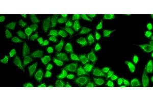 Immunofluorescence analysis of HeLa cells using CD127 Polyclonal Antibody (IL7R 抗体)