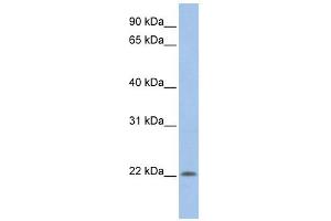 UBE2M antibody used at 1 ug/ml to detect target protein. (UBE2M 抗体)