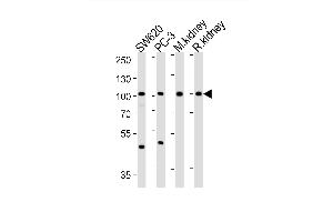 Western blot analysis of lysates from S, PC-3 cell line, mouse kidney, rat kidney tissue lysate (from left to right), using SUPV3L1 Antibody (N-term) (ABIN1881857 and ABIN2843036).