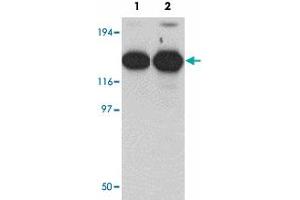 Western blot analysis of ZMYM2 in EL4 cell lysate with ZMYM2 polyclonal antibody  at (1) 0. (ZMYM2 抗体  (C-Term))