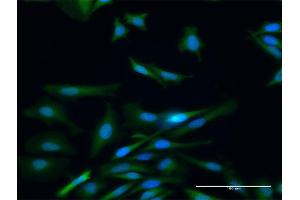 Immunofluorescence of purified MaxPab antibody to PADI4 on HeLa cell. (PAD4 抗体  (AA 1-663))