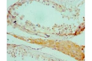 Immunohistochemistry of paraffin-embedded human testis tissue using ABIN7168578 at dilution of 1:100 (SALL4 抗体  (AA 1-220))