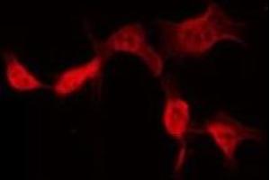 ABIN6275402 staining Hela by IF/ICC. (POTEB 抗体)