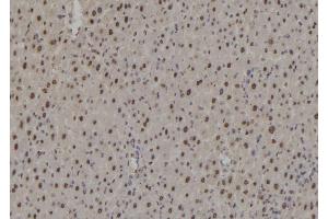 ABIN6276941 at 1/100 staining Rat liver tissue by IHC-P. (RAD9A 抗体  (C-Term))