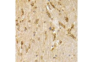 Immunohistochemistry of paraffin-embedded mouse brain using APLP1 antibody at dilution of 1:200 (400x lens). (APLP1 抗体)