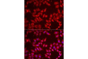 Immunofluorescence analysis of HeLa cell using BAP1 antibody. (BAP1 抗体)