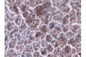 #VALUE! (MRPL1 抗体  (AA 143-336))