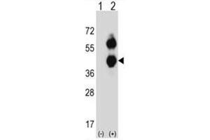 Western blot analysis of BCAT2 (arrow) using rabbit polyclonal BCAT2 Antibody (C-term) . (BCAT2 抗体  (C-Term))